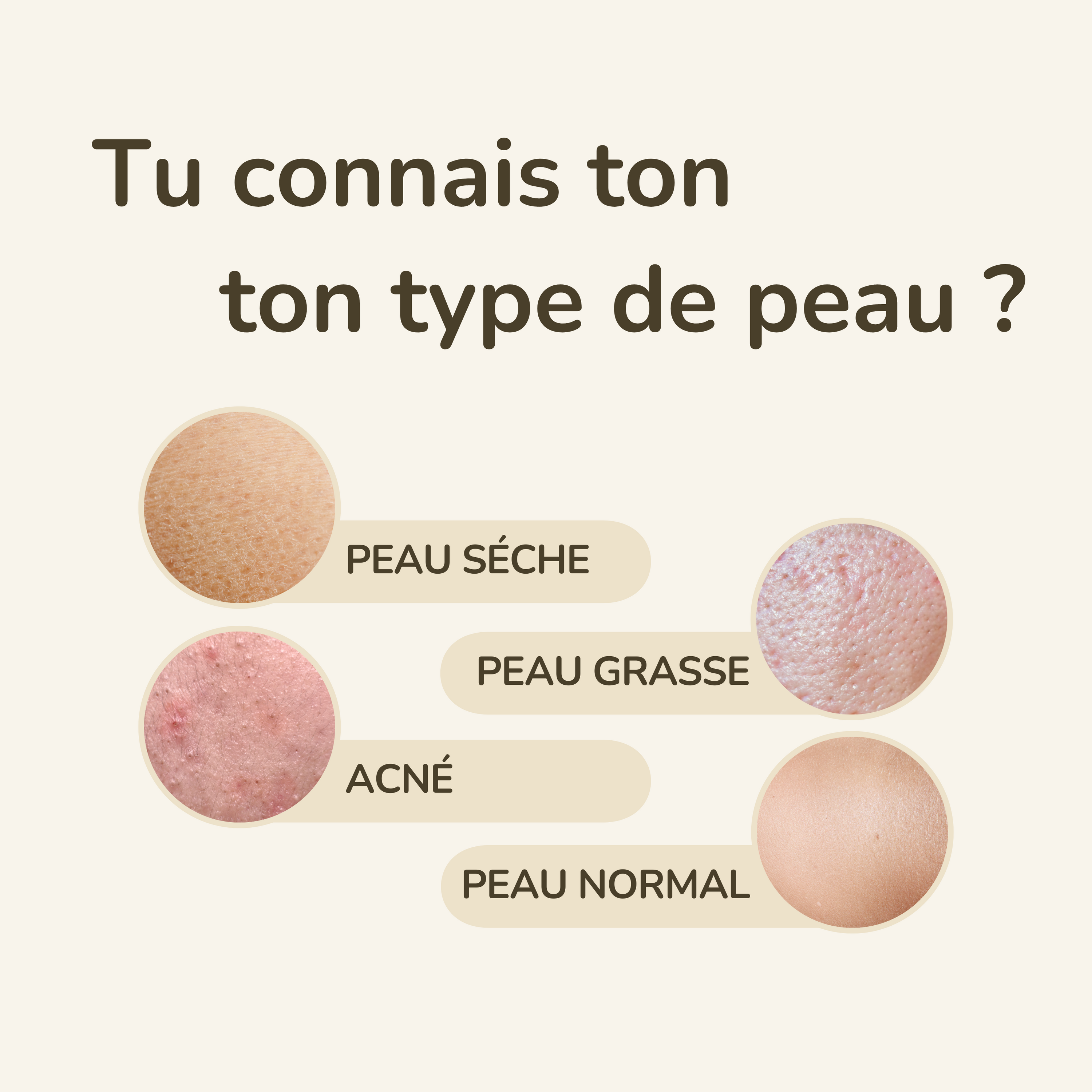 Les Différents Types de Peau et Comment Choisir le Bon Savon